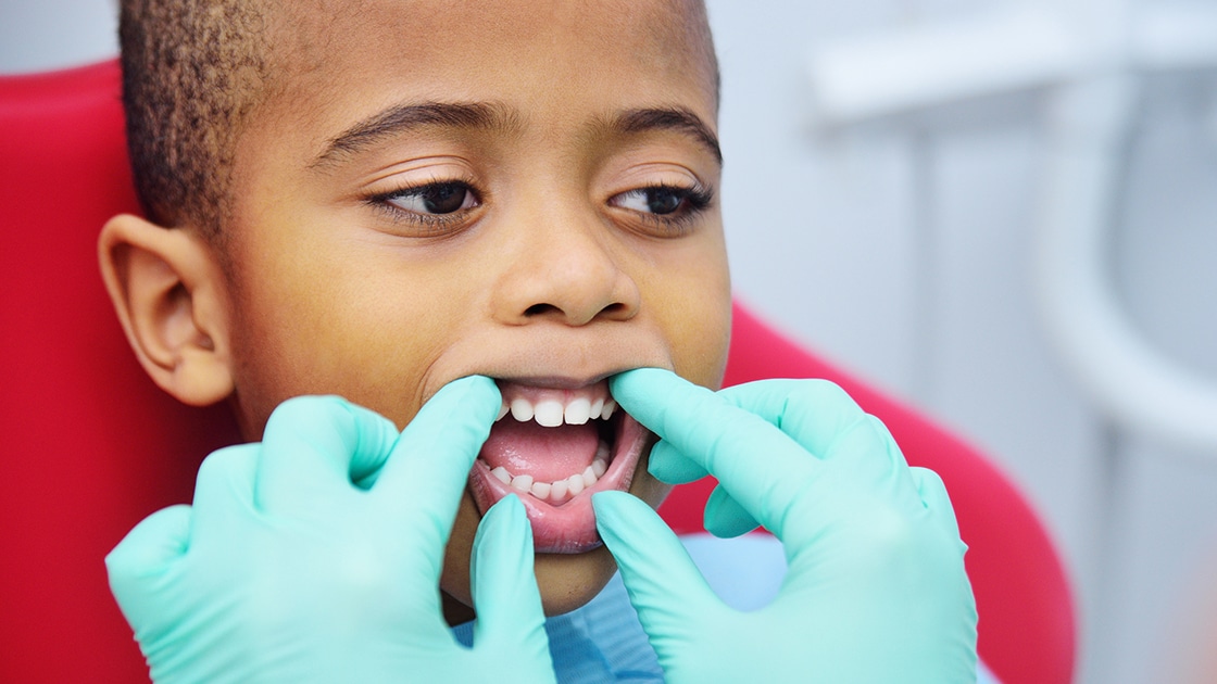 Pediatric Dental Exam photo