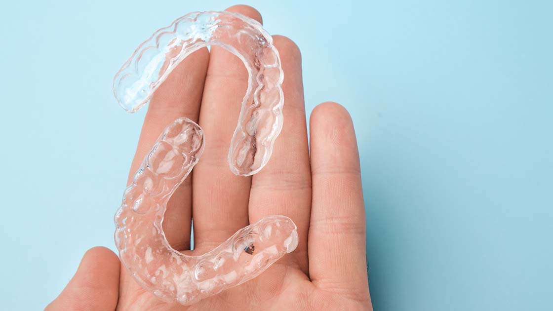 clear aligners