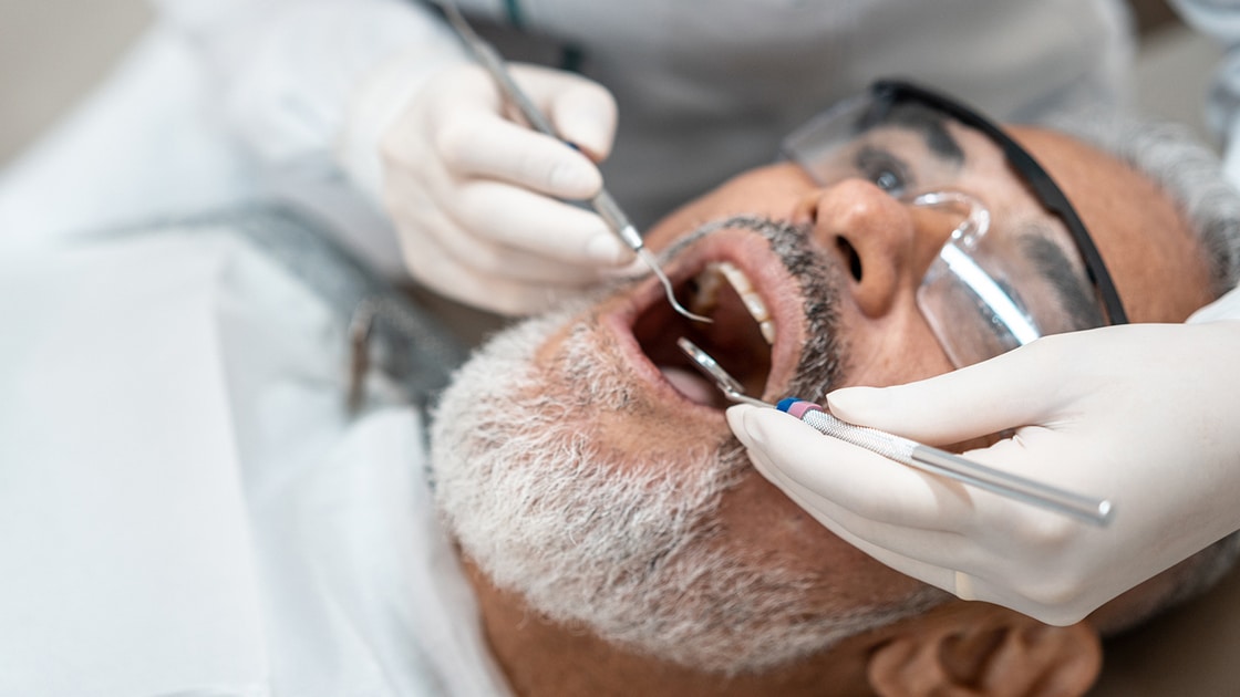 Man getting dental check up